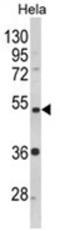 Protein Phosphatase 2 Regulatory Subunit Bbeta antibody, AP18157PU-N, Origene, Western Blot image 