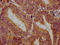 Tripartite Motif Containing 26 antibody, LS-C681600, Lifespan Biosciences, Immunohistochemistry paraffin image 