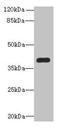 Paraneoplastic antigen Ma1 antibody, CSB-PA018266LA01HU, Cusabio, Western Blot image 