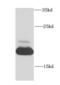 Mitochondrial Ribosomal Protein L12 antibody, FNab05315, FineTest, Western Blot image 