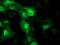 Striatin Interacting Protein 1 antibody, MA5-25392, Invitrogen Antibodies, Immunocytochemistry image 