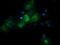 Retinoic Acid Receptor Responder 1 antibody, M10039-1, Boster Biological Technology, Immunofluorescence image 