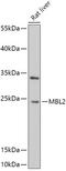 Mannose Binding Lectin 2 antibody, GTX54368, GeneTex, Western Blot image 