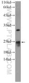 ER Membrane Protein Complex Subunit 9 antibody, 23919-1-AP, Proteintech Group, Enzyme Linked Immunosorbent Assay image 