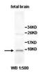 Heat Shock Factor Binding Protein 1 antibody, orb77925, Biorbyt, Western Blot image 