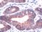 CCN1 antibody, PA5-32375, Invitrogen Antibodies, Immunohistochemistry paraffin image 