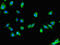 Unconventional SNARE In The ER 1 antibody, CSB-PA889157LA01HU, Cusabio, Immunofluorescence image 