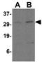 Programmed Cell Death 1 Ligand 2 antibody, GTX85449, GeneTex, Western Blot image 