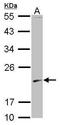 S-Phase Kinase Associated Protein 1 antibody, PA5-29424, Invitrogen Antibodies, Western Blot image 