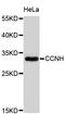 Cyclin H antibody, abx126852, Abbexa, Western Blot image 