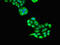 Unc-51 Like Autophagy Activating Kinase 1 antibody, orb53083, Biorbyt, Immunocytochemistry image 