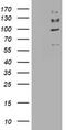 ALK Receptor Tyrosine Kinase antibody, TA801262BM, Origene, Western Blot image 