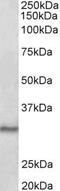 SCP1 antibody, PA5-37961, Invitrogen Antibodies, Western Blot image 