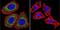 Nuclear Receptor Subfamily 3 Group C Member 1 antibody, GTX22768, GeneTex, Immunofluorescence image 