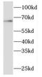 Malic Enzyme 1 antibody, FNab05079, FineTest, Western Blot image 