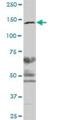 Structural Maintenance Of Chromosomes 3 antibody, H00009126-B01P, Novus Biologicals, Western Blot image 