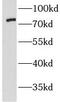 Lipase Maturation Factor 2 antibody, FNab04806, FineTest, Western Blot image 