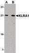 T-cell surface glycoprotein YE1/48 antibody, PA5-20674, Invitrogen Antibodies, Western Blot image 