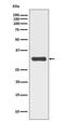 Replication Protein A2 antibody, P02067-1, Boster Biological Technology, Western Blot image 