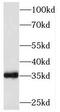 SEC14 And Spectrin Domain Containing 1 antibody, FNab08110, FineTest, Western Blot image 
