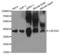 Capping Actin Protein Of Muscle Z-Line Subunit Alpha 2 antibody, A2054, ABclonal Technology, Western Blot image 