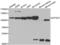 Eukaryotic Translation Initiation Factor 4 Gamma 2 antibody, abx002128, Abbexa, Western Blot image 