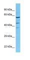 Small Nuclear Ribonucleoprotein U1 Subunit 70 antibody, orb327323, Biorbyt, Western Blot image 