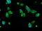 Solute Carrier Family 7 Member 8 antibody, GTX83621, GeneTex, Immunocytochemistry image 