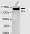 Structural Maintenance Of Chromosomes 1A antibody, LS-C178300, Lifespan Biosciences, Western Blot image 