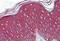 Keratin 17 antibody, MBS245942, MyBioSource, Immunohistochemistry frozen image 