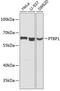 Polypyrimidine Tract Binding Protein 1 antibody, GTX54619, GeneTex, Western Blot image 