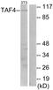 TATA-Box Binding Protein Associated Factor 4 antibody, PA5-38515, Invitrogen Antibodies, Western Blot image 