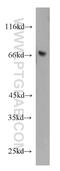 Killer Cell Lectin Like Receptor F1 antibody, 21510-1-AP, Proteintech Group, Western Blot image 