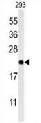 Melanocortin-2 receptor accessory protein antibody, AP52742PU-N, Origene, Western Blot image 
