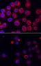 Bruton Tyrosine Kinase antibody, MAB7205, R&D Systems, Immunofluorescence image 