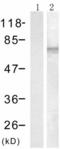 Protein Tyrosine Phosphatase Non-Receptor Type 11 antibody, TA321539, Origene, Western Blot image 