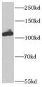 Inv antibody, FNab04369, FineTest, Western Blot image 