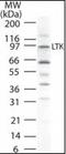 Leukocyte tyrosine kinase receptor antibody, orb87936, Biorbyt, Western Blot image 