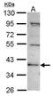 C2 Calcium Dependent Domain Containing 2 antibody, PA5-30727, Invitrogen Antibodies, Western Blot image 