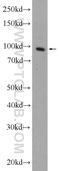 Transportin 1 antibody, 20679-1-AP, Proteintech Group, Western Blot image 