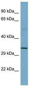 Beta-sarcoglycan antibody, TA334660, Origene, Western Blot image 