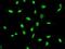 Transcription Factor AP-2 Alpha antibody, ab108311, Abcam, Immunocytochemistry image 