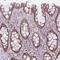 Dachsous Cadherin-Related 1 antibody, NBP2-13902, Novus Biologicals, Immunohistochemistry paraffin image 