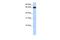 Zinc Finger Protein 14 antibody, PA5-43693, Invitrogen Antibodies, Western Blot image 