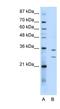 Ribosome Production Factor 1 Homolog antibody, NBP1-80467, Novus Biologicals, Western Blot image 