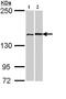 Fanconi anemia group A protein antibody, ab97578, Abcam, Western Blot image 