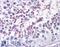 Dual Specificity Phosphatase 14 antibody, 45-505, ProSci, Enzyme Linked Immunosorbent Assay image 