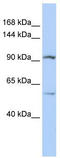 Leucine Rich Repeat Containing 66 antibody, TA336062, Origene, Western Blot image 