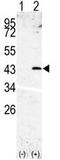 Signal Peptide Peptidase Like 3 antibody, AP13339PU-N, Origene, Western Blot image 