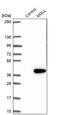 Monoglyceride Lipase antibody, PA5-52890, Invitrogen Antibodies, Western Blot image 